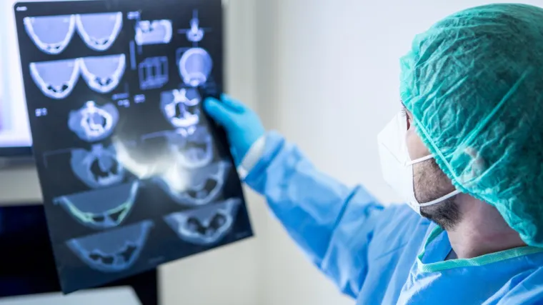 Koronavirus može prodrijeti u mozak i tamo se umnožavati