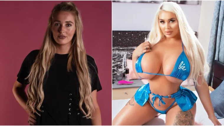 Ima 22 godine i ovisna je o plastičnim operacijama; 'Prije me ba&scaron; nitko nije primjećivao'