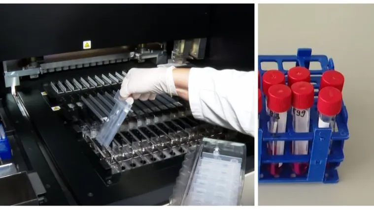 Kako prepoznati ima li netko gripu ili koronu? U Zavodu Andrija Štampar spremni su za istodobna testiranja