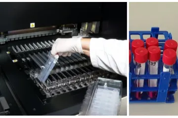 Kako prepoznati ima li netko gripu ili koronu? U Zavodu Andrija Štampar spremni su za istodobna testiranja