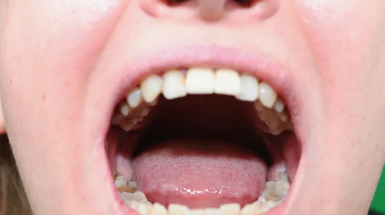 Znanstvenici otkrili nekoliko promjena koje se pojavljuju u kratkom vremenskom razdoblju