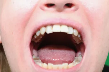 Znanstvenici otkrili nekoliko promjena koje se pojavljuju u kratkom vremenskom razdoblju