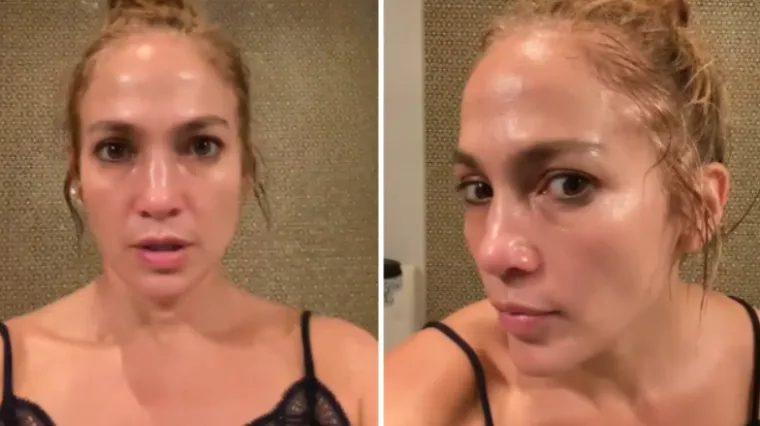 'Ima&scaron; tone botoksa'; ovaj put pjevačica nije mogla pre&scaron;utjeti