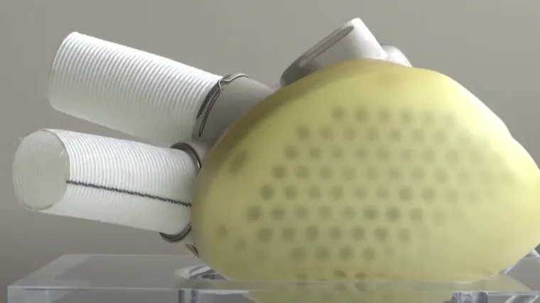 Odlična vijest za očajne pacijente: Europska unija dala zeleno svjetlo za ugradnju prvog potpuno umjetnog srca