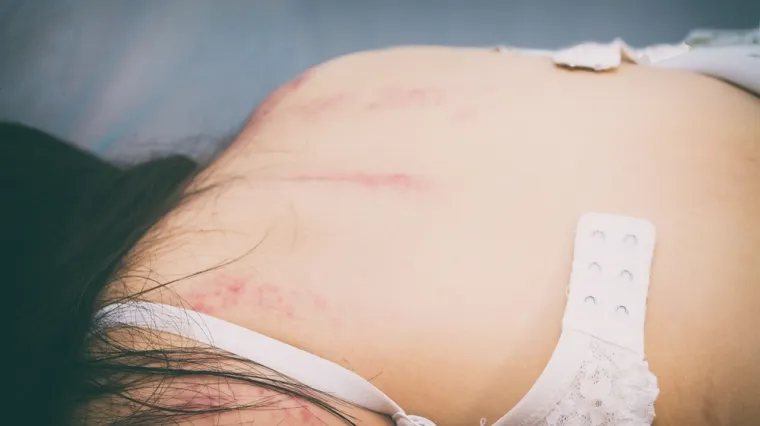 U deset dana prijavljeno je vi&scaron;e od 30 slučajeva spolnog uznemiravanja: 'Važno je da žrtve progovore'