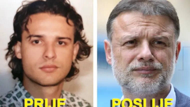 Jandroković objavio sliku prije i poslije... Pa ovo nisu istine!