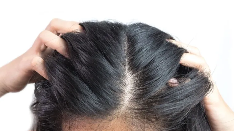 Evo &scaron;to je perut i kako je se napokon rije&scaron;iti!