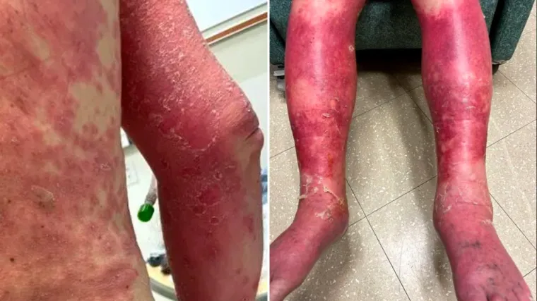 'Ne oklijevajte, sretan sam &scaron;to sam primio prvu dozu'