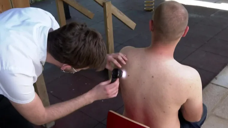 Na besplatnom pregledu madeža u Zagrebu tumore su otkrili kod svakog osmog koji im se javio