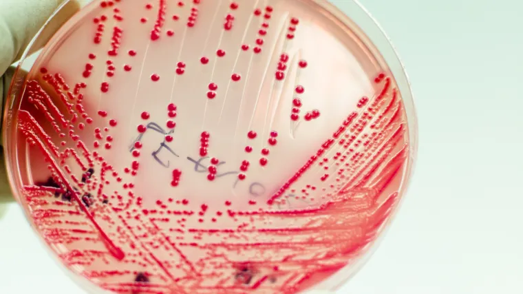 Escherichia coli - normalan stanovnik našeg tijela i čest uzročnik bolesti
