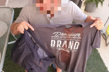 FOTO Napad na Pagu: 'Došli su na terasu apartmana i teleskopskom palicom su mi razbili glavu'