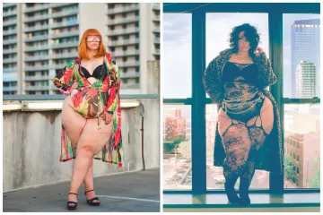 Zbog rijetkog poremećaja ima abnormalno velika bedra: Umjesto dijeta, sada zarađuje milijune