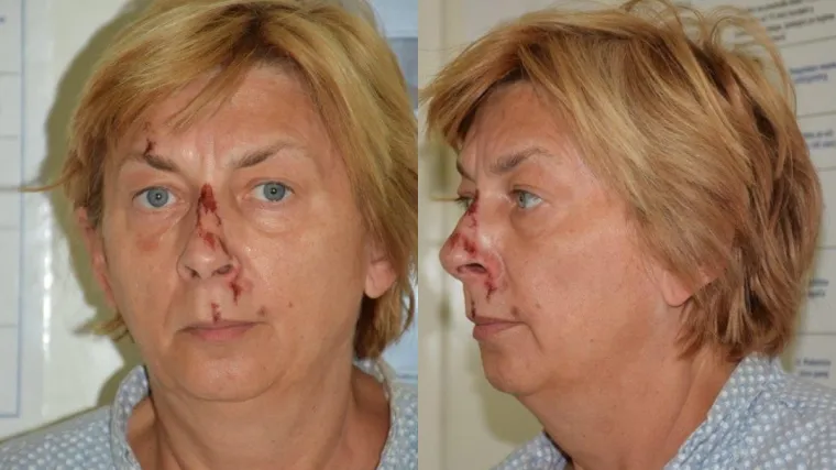 Znate li tko je ova žena? Policija ju je prona&scaron;la na Krku ozlijeđenu i ne sjeća se tko je