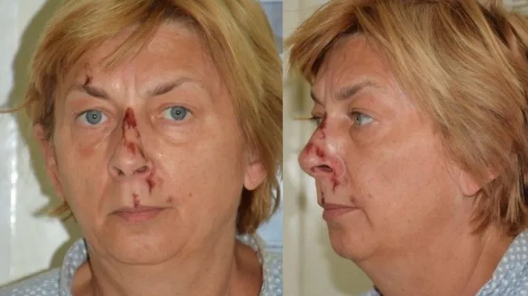 O ženi koja je pronađena na Krku pi&scaron;e i CNN: Tečno priča engleski, ali ne zna kako se zove