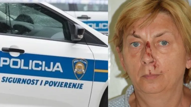 Misterij konačno rije&scaron;en! Žena s Krka je Slovakinja Daniela: 'Fizički je dobro, ali i dalje nema pomaka u povratku pamćenja'