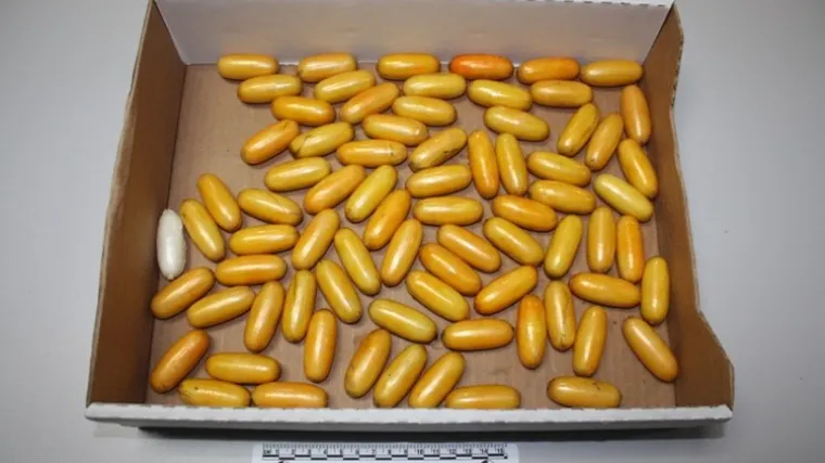 Na 'Tuđmanu' pala Brazilka: U crijevima i želucu prenosila je skoro 1 kg kokaina u kapsulama