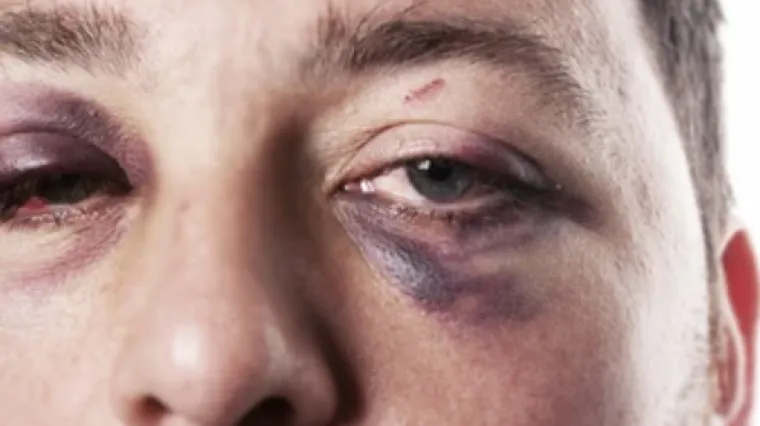 Braća iz Splita oti&scaron;la ocu po lijekove, pa ih pretukli policajci. Dosuđeno im je 500.000 kuna od&scaron;tete