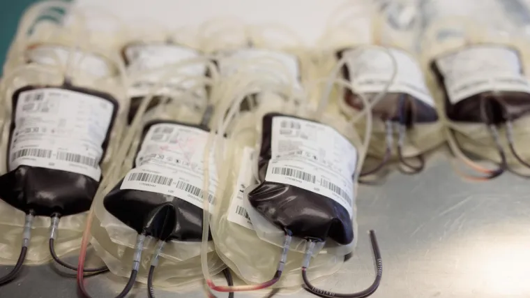 U Rijeci nedostaje krvne grupe A+ i B+, mole se građani da se odazovu darivanju krvi