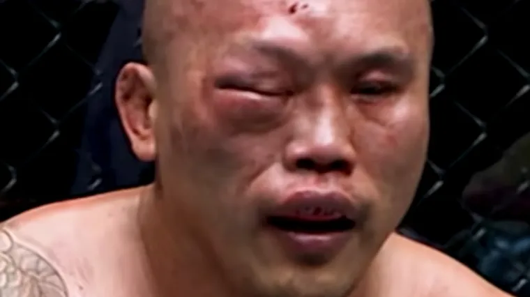 Izgledao je izobličeno od batina, krvario je, a onda &scaron;okirao borilački svijet