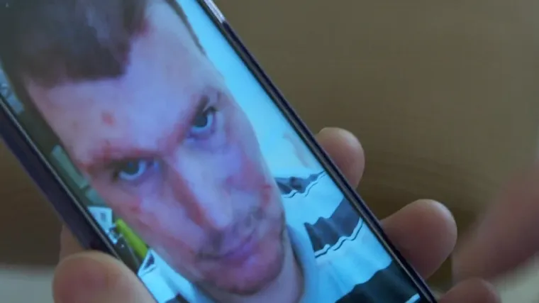 Čovjek kojeg je napala divlja svinja za RTL ispričao &scaron;to se sve događalo: 'Odbacila me metar i pol, gurala me do drva. Uspio sam je prevrnuti'