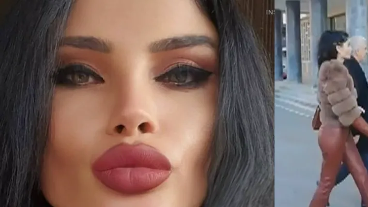 Nakon tretmana za ljepotu kod Nadri Barbie, ostajale su opekline, no njen odvjetnik tvrdi: 'Potpisale su suglasnost'