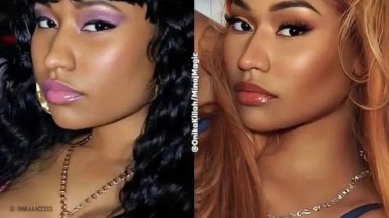 Nicki Minaj objavila staru fotografiju pa slučajno otkrila da je imala više plastičnih operacija