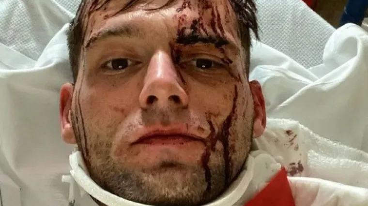 Borac doživio zastra&scaron;ujuću ozljedu: Kavez mu otvorio glavu 20 cm; 'U &scaron;oku smo, komisija je pregledala kavez'