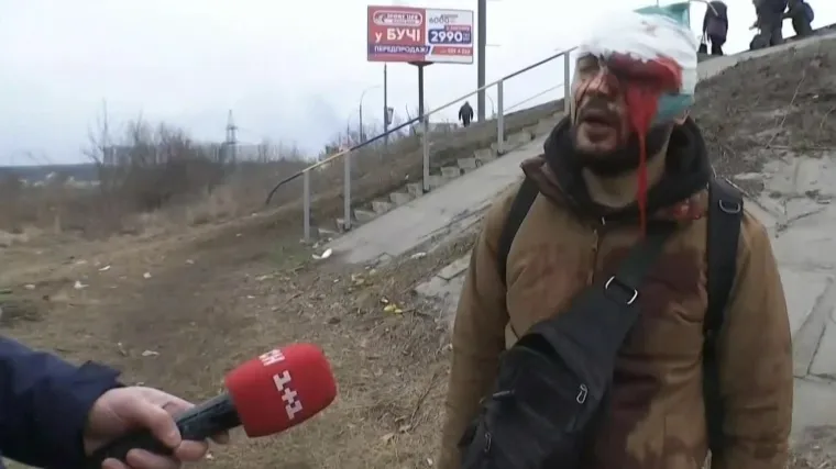 Na tisuće civila, žena i djece padaju ruske granate i bombe, 11. dan rata u Ukrajini: Točan broj žrtava jo&scaron; se ne zna