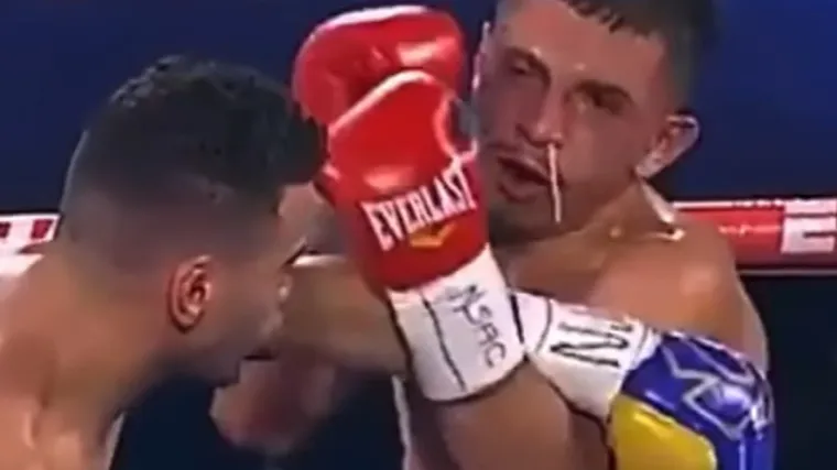 Ovako ne&scaron;to bolesno u boksu niste jo&scaron; vidjeli. Ljudi vri&scaron;te od smijeha; 'To je čak možda i komadić mozga'