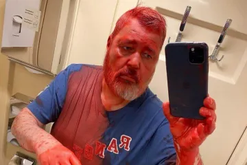 SAD tvrdi da iza napada na ruskog nobelovca stoji obavještajna zajednica: No, u njihovoj priči postoji jedan problem