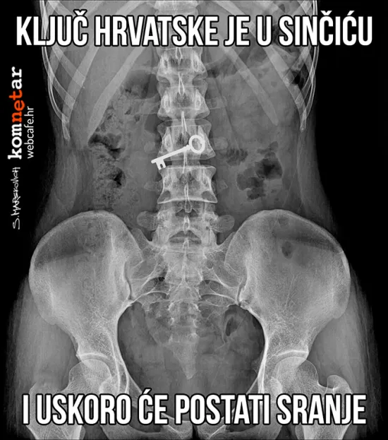 Ako ne dođe do komplikacija...