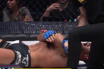 Uvjerljivo jedna od najgorih ozljeda u povijesti MMA-a. Pogledajte zastrašujući lom ruke KSW-ova boraca