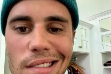 Virus koji je Justinu Bieberu paralizirao lice imaju svi koji su preboljeli vodene kozice! Ovo su simptomi da se ponovno aktivirao