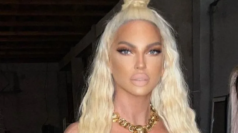 Karleuša bradavice prekrila dolarima pa se zaogrnula zlatom i izbacila obline: 'Ovo može samo ona'