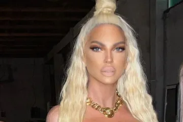 Karleuša bradavice prekrila dolarima pa se zaogrnula zlatom i izbacila obline: 'Ovo može samo ona'