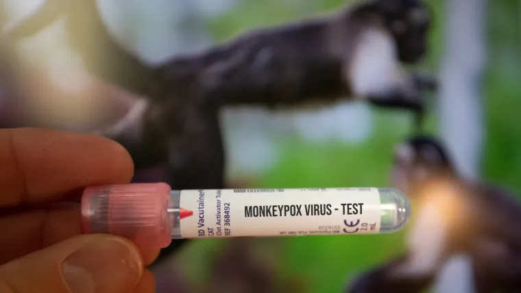 WHO tvrdi da ne treba otkazivati europske ljetne festivale zbog majmunskih boginja