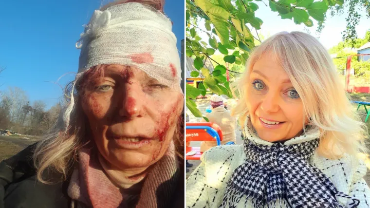 Ukrajinka koja je postala simbol Putinove invazije volontira u Poljskoj: 'Imam puno ljubavi i želim je dati djeci'