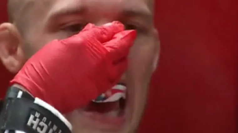 UZNEMIRUJUĆ VIDEO Ovo je najgori lom nosa u MMA povijesti
