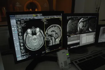 Odlične vijesti za pacijente! Važnu pretragu od sada možete napraviti u privatnoj poliklinici, na račun HZZO-a