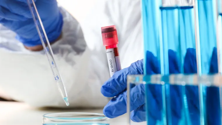 U posljednja 24 sata imamo 455 novih slučajeva zaraze, preminulo još 11 ljudi