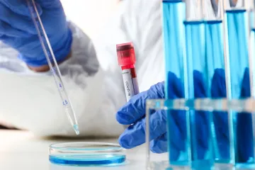 U posljednja 24 sata imamo 455 novih slučajeva zaraze, preminulo još 11 ljudi