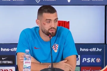 VIDEO Kovačić otkrio kako je zaradio 'šljivu' ispod oka koja je privukla pažnju na presici