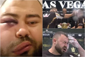 Pobjednik u kontroverznom šamaranju završio deformiranog lica: Natečena masa šokirala svijet, stvara se 'zvijer' u mozgu; 'Je li vrijedno toga?!'