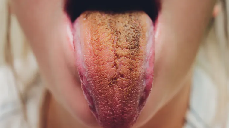 Ovo je osam najprljavijih dijelova tijela: Liječnica upozorava što vam se može dogoditi ako ih ne perete svaki dan