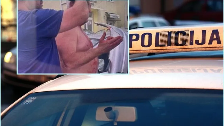 Dubrovački HDZ-ovac vozio s 1,64 promila u krvi pa se zabio u kamenu ogradu
