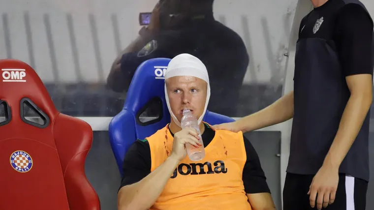 Policija identificirala navijača koji je bocom u glavu pogodio igrača Istre: Evo kakvu je kaznu dobio