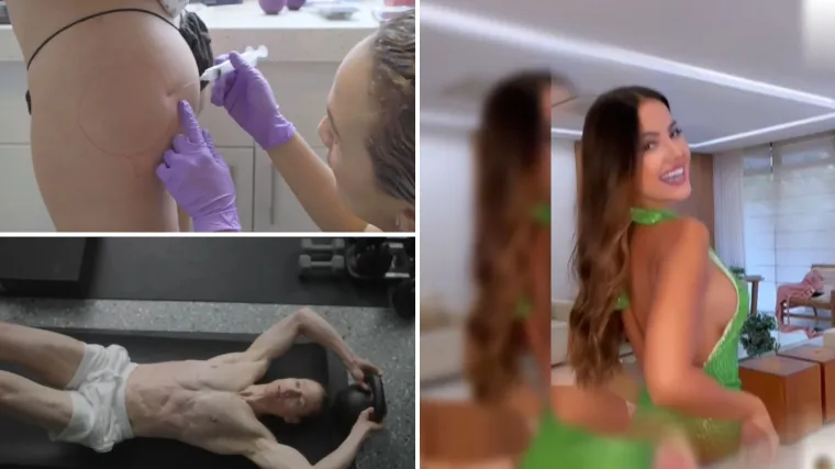 Milijarder na šok terapiji za penis, manekenka umrla na liposukciji koljena. Koliko smo daleko spremni ići?