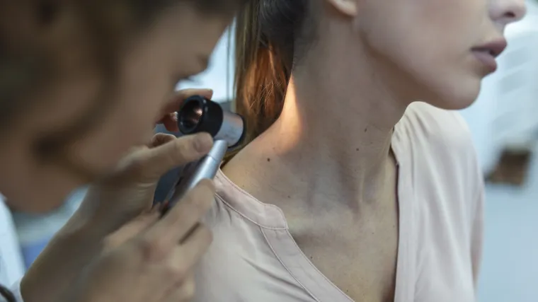 Kada je potrebno ukloniti madež?