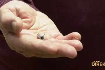 Nizozemac pomoću misli hoda. Kritičari u čipiranju mozga vide put u 'umobolnu propagandu', no prvi pacijent već se oporavlja