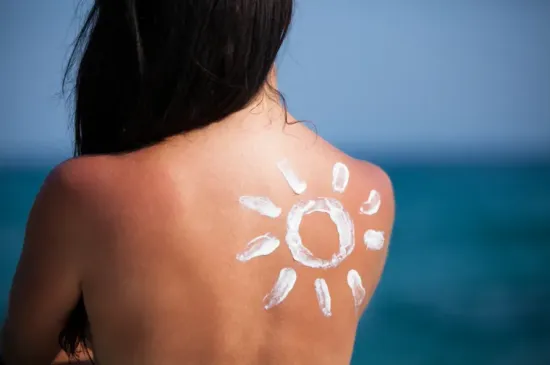 Kako prepoznati alergiju na sunce? Donosimo prirodne načine za liječenje